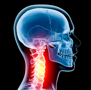 Neck and Back Injury Lawyer in Chicago